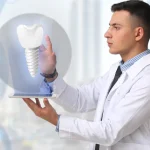 Cena implantu zęba Szczecin